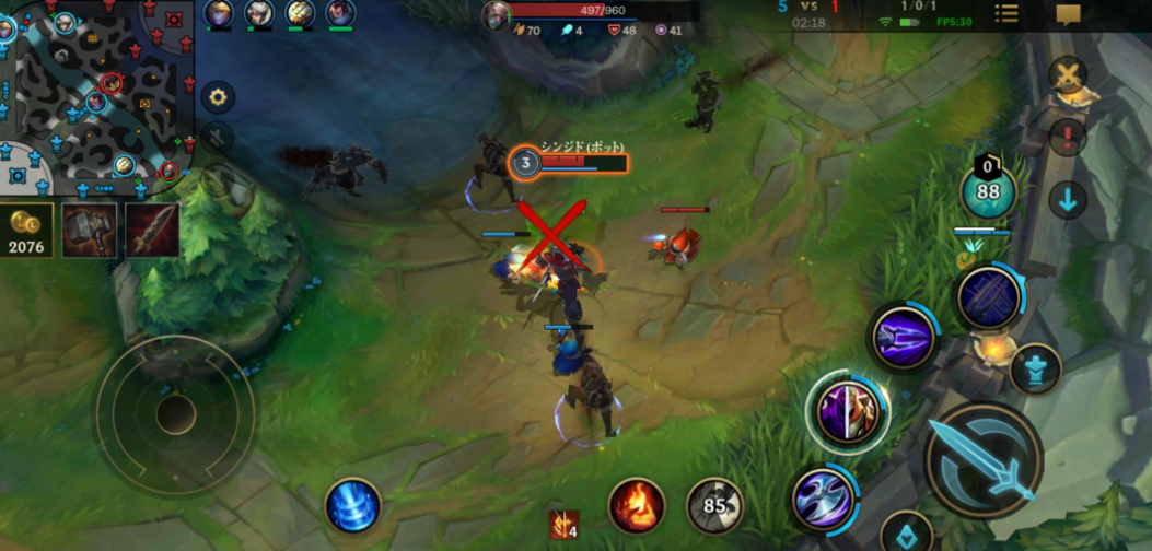 英雄联盟手游里哪个英雄连招最秀